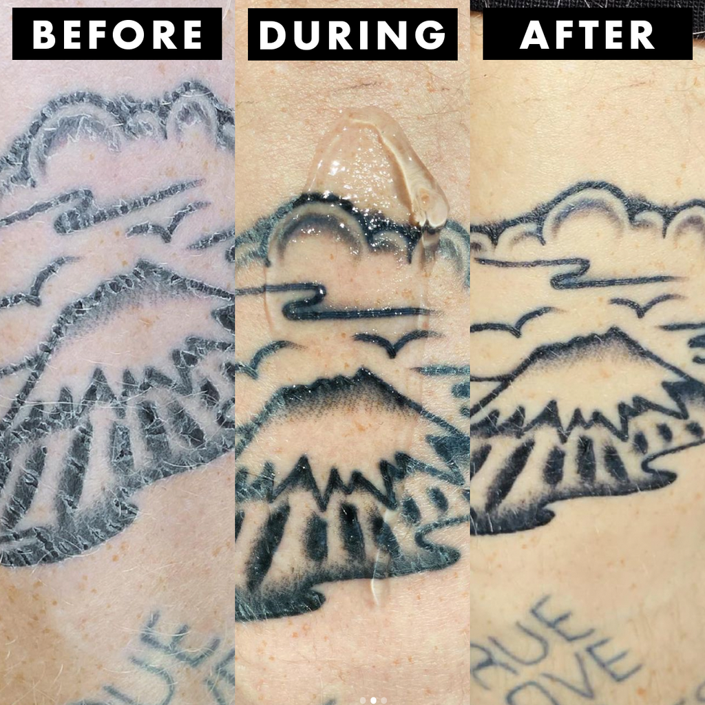 Tattoo Soothing Gel